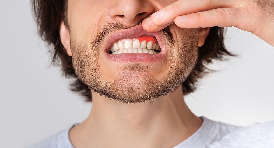 HOW TO PROTECT YOUR SMILE FROM PERIODONTAL DISEASE?