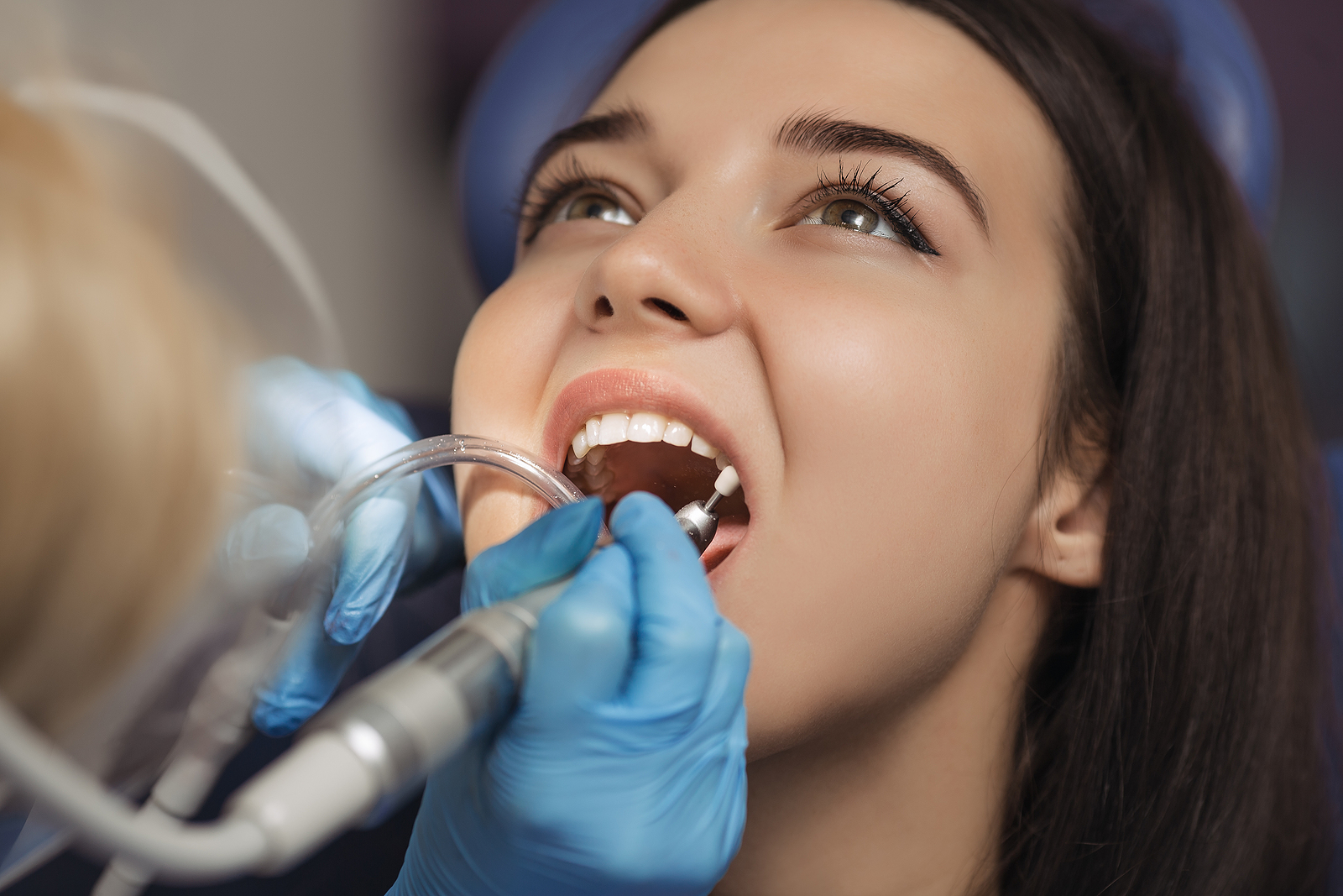 Understanding the Basics: What Is General Dentistry and How Can It Benefit You?